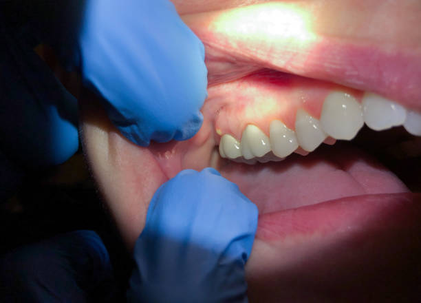 Best Cosmetic Emergency Dentistry in Cayuga Heights, NY